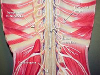 01 Ganglia-intercostal nerves-cauda equina-conus medullaris-01 : conus medullaris, cauda equina, sympathetic trunk ganglia, intercostal nerves