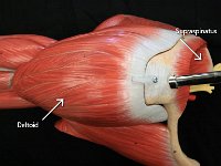 01 Supraspinatus-deltoid : supraspinatus, deltoid, shoulder muscle