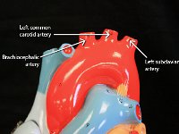 01 Aortic arch-ascending aorta-descending aorta : left common carotid artery, left subclavian artery, brachiocephalic artery, aortic arch