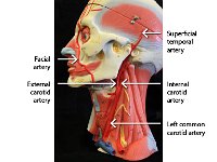 03 Facial Arteries-01 : facial artery, external carotid Artery, superficial temporal artery, internal carotid artery, left common carotid artery