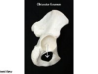 03 Obturator foramen-01 : obturator foramen, ilium, ischium, pelvic girdle