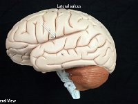 04 Lateral sulcus-01 : lateral sulcus, parietal lobe, temporal lobe, human brain anatomy