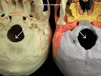 05 Foramen magnum-01 : occipital bone, hole, cranial bone, skull, foramen magnum