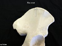 05 Iliac Crest-01 : iliac crest, ilium, superior portion, pelvic girdle