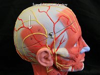 05 Superficial temporal artery-01 : superficial temporal artery, arteries of the head, external carotid artery, temporal bone