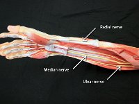 06 Radial-media-Ulnar nerve-01 : radial nerve, median nerve, ulnar nerve, spinal cord plexus