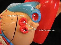 06 left pulmonary artery-vein : left pulmonary artery, left pulmonary vein, heart
