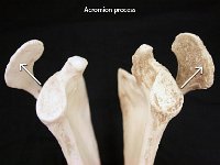 07 Acromion process : acromion process, spine of the scapula, coracoacromial ligament, pectoral girdle