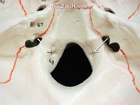 07 Hypoglossal Foramen : hypoglossal foramen, occipital bone, holes, cranial bone, skull