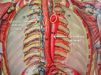 07 Intercostal-descending aortas : intercostal arteries, descending aorta, thorax, ribs