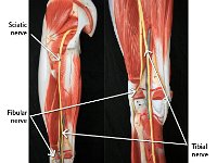 07 Sciatic-Tibial-Fibular nerve-01 : sciatic nerve, tibial nerve, fibular nerve, spinal cord plexus