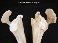 09 Coracoid process of scapula-01 : coracoid process, scapula, glenoid fossa, pectoral girdle