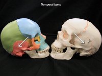 09 Temporal Bone-01 : temporal, ear, cranial bone, skull