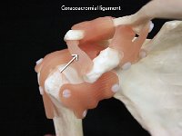 10 Coracoacromial ligament : coracoacromial ligament, coracoid, acromion, pectoral girdle