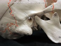 09 External acoustic canal : temporal bone, hole, cranial bone, skull