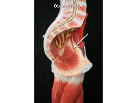 10 Obturator nerve : obturator nerve, thigh lumbosacral plexus, spinal cord plexus