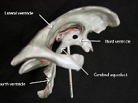 10 third-fourth-lateral ventricle-cerebral aquaduct : third ventricle, fourth ventricle, lateral ventricle, cerebral aqueduct