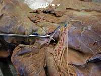 11 Axillary nerve : axillary nerve, armpit, brachial plexus, cat spinal nerve plexus