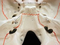 10 internal acoustic canal : temporal bone, canal, cranial bone, skull