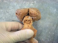 12 Occipital lobe : occipital lobe, posterior, sheep, anatomy of sheep brain