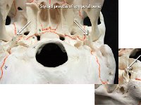 12 Styloid Process of temporal bone : styloid, temporal, cranial bone, skull