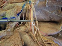 13 Radial nerve : radial nerve, brachial plexus, cat, cat spinal nerve plexus