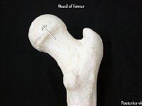14 Head of Femur-01 : head of femur, femur, acetabulum, lower limb
