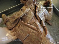 14 Trapezius group-latissimus dorsi : trapezius, latissimus dorsi, posterior muscles, chest and pelvic muscles