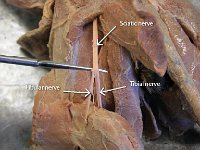 15 Femoral nerve : femoral nerve, thigh, cat, cat spinal nerve plexus