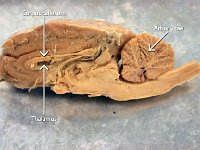 15 corpus callosum-thalamus-arbor vitae : corpus callosum, thalamus, arbor vitae, anatomy of sheep brain