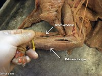 06 Brachioradialis-Palmaris longus : palmaris longus, foot, upper limb muscle, cat muscular system