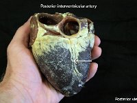 16 Posterior interventricular artery : posterior interventricular artery, posterior side, pig heart, sheep heart