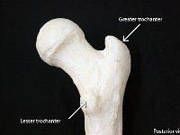16 Trochanter-01 : greater trochanter, lesser trochanter, femur, lower limb