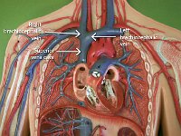 16 right-left brachiocephalic vein-superior vena cava-01 : superior vena cava, right brachiocephalic vein, left brachiocephalic vein, superior heart region