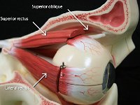 16 superior-lateral rectus-superior oblique : superior rectus, lateral rectus, superior oblique, eye anatomy