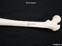 17 Linea aspera : linea aspera, line, femur, lower limb