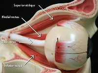 17 Optic nerve-superior-inferior rectus-superior oblique-01 : optic nerve, inferior rectus, medial rectus, superior oblique