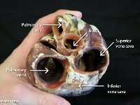 17 Pulmonary trunk-veins-Aorta-Superior-Inferior vena cava-01 : aorta, pulmonary trunk, pulmonary veins, superior vena cava, inferior vena cava