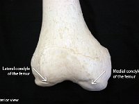 18 Condyle of the femur : condyle of the femur (anterior view), medial condyle of femur, lateral condyle of femur, femur, lower limb