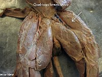 18 Quadraceps femoris group : quadriceps femoris group, thigh, lower limb muscles, cat muscular system