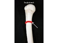 18 Surgical neck : surgical neck, anatomical neck, tubercles, upper limb