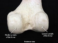 19 Condyle of the femur : condyle of the femur (posterior view), medial condyle of femur, lateral condyle of femur, femur, lower limb
