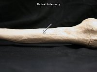 19 Deltoid Tuberosity-01 : deltoid tuberosity, deltoid, humerus, upper limb