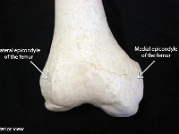20 Epicondyle of the femur-01 : medial epicondyle of femur, lateral epicondyle of femur, femur, lower limb