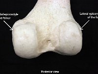 21 Epicondyle of the femur-01 : medial epicondyle of femur, lateral epicondyle of femur, femur, lower limb