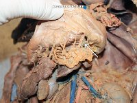 20 Greater omentum : greater omentum, stomach, large intestine, cat digestive system