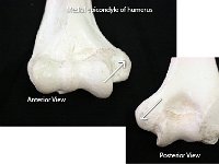 22 Medial epicondyle of humerus-01 : medial epicondyle of humerus, distal end, medial side, upper arm