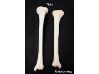 23 Tibia : tibia, medial bone, lower leg, lower limb