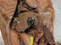 24 Gall bladder-Liver-cecum-large intestine-01 : large intestine, gall bladder, cecum, liver