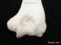 24 Olecranon fossa : olecranon fossa, elbow, humerus, upper limb